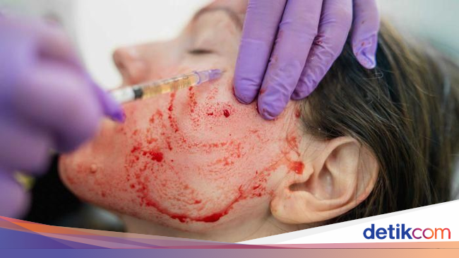 gerakan yoga biar awet muda cara bikin wajah pria awet muda