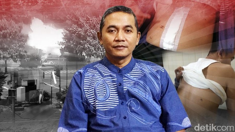 Aiptu Budiono: 3 Peluru Menembus Tubuh, Merusak Usus dan Paru-paru Aiptu Budiono: 3 Peluru Menembus Tubuh, Merusak Usus dan Paru-paru
