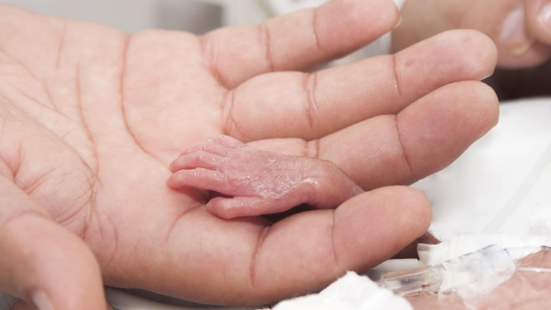 Cerita Ayah yang Anaknya Lahir Prematur di Kehamilan 25 Minggu/ Foto: Thinkstock Cerita Ayah yang Anaknya Lahir Prematur di Kehamilan 25 Minggu/ Foto: Thinkstock