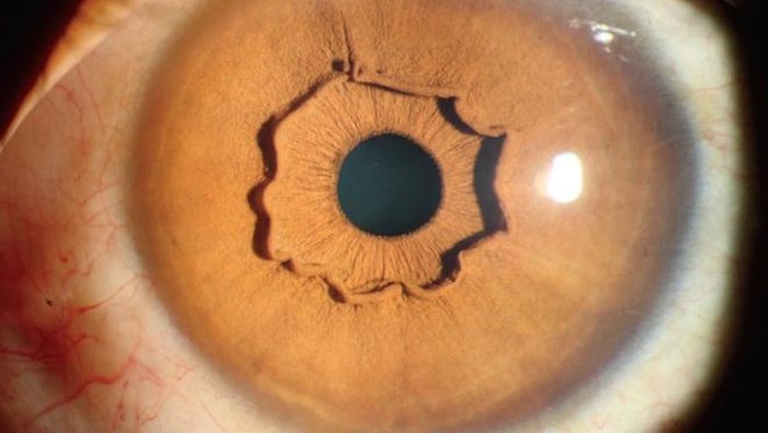 Foto: The New England Journal of Medicine Foto: The New England Journal of Medicine
