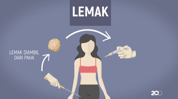 Foto: 20detik Foto: 20detik