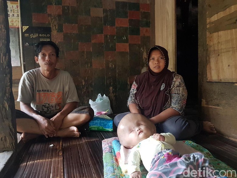 Kisah Bayi Hidrosefalus Asal Serang yang Divonis Tak akan Sembuh Kisah Bayi Hidrosefalus Asal Serang yang Divonis Tak akan Sembuh