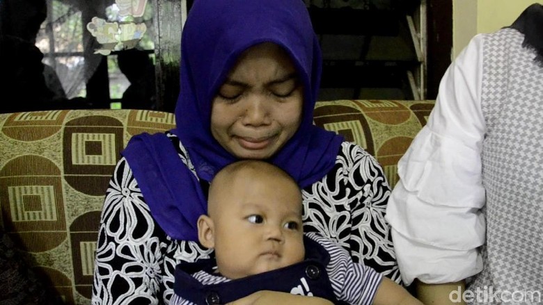 Bayi Pekalongan yang Kehilangan Sekat Hidung Akan Dibedah Plastik Bayi Pekalongan yang Kehilangan Sekat Hidung Akan Dibedah Plastik