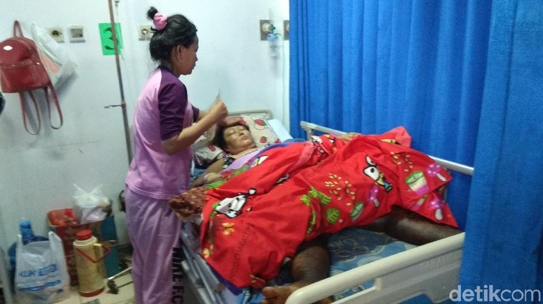 Terkena Penyakit Aneh, Kaki Heni asal Karawang Seperti Kayu Terkena Penyakit Aneh, Kaki Heni asal Karawang Seperti Kayu