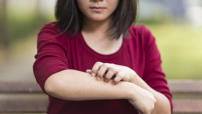 Fakta-fakta Alergi pada Anak yang Bunda Perlu Tahu/ Foto: Thinkstock Fakta-fakta Alergi pada Anak yang Bunda Perlu Tahu/ Foto: Thinkstock