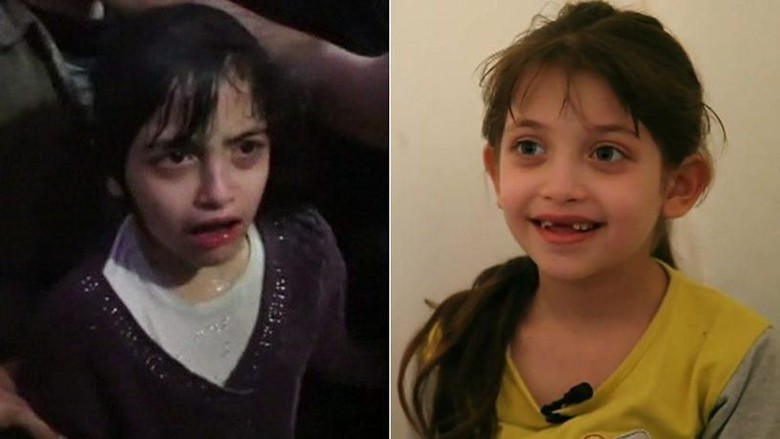 Cerita Pilu Anak di Suriah Berjuang saat Kena Serangan Kimia Cerita Pilu Anak di Suriah Berjuang saat Kena Serangan Kimia