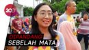 Minimnya Lapangan Pekerjaan untuk Down Syndrome Minimnya Lapangan Pekerjaan untuk Down Syndrome