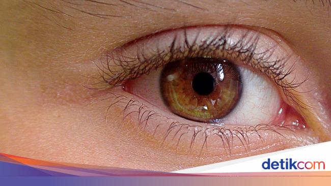 Tubuh Kedutan Dan Bergetar Pertanda Apa