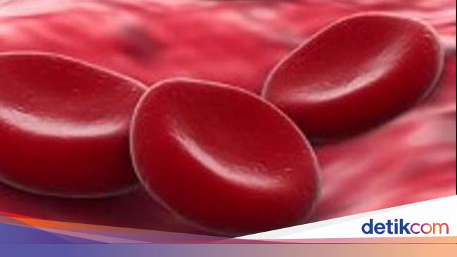 Penyakit Darah Kenali Jenis Dan Penyebabnya Penyakit Darah Kenali Jenis Dan Penyebabnya
