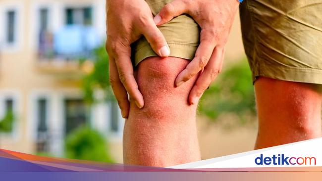 Bukan Cuma Karena Lemak Ini 12 Alasan Kakimu Membengkak