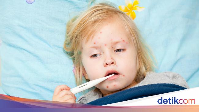 Anak yang Sakit Campak  Diberi Air Kelapa Hijau Agar Cepat  Anak yang Sakit Campak  Diberi Air Kelapa Hijau Agar Cepat