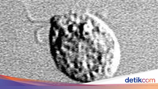 Brain-eating amoeba Takes Boy’s Life to Make Texas Disaster Emergency