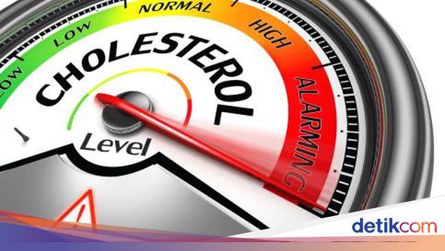 Signs of High and Dangerous Cholesterol Levels: What to Watch Out For