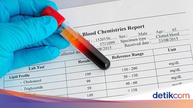 Berapa Kadar Kolesterol Normal Ini Penjelasannya Berdasarkan Usia