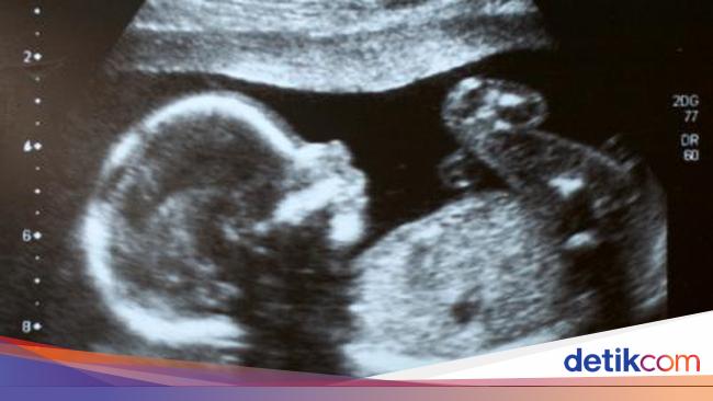 Faktor-faktor yang Pengaruhi Aktif atau Pasifnya Gerakan Janin Faktor-faktor yang Pengaruhi Aktif atau Pasifnya Gerakan Janin