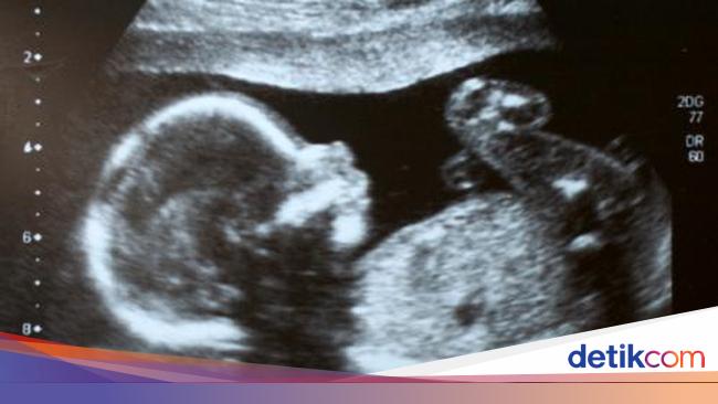 Faktor Faktor Yang Pengaruhi Aktif Atau Pasifnya Gerakan Janin Faktor Faktor Yang Pengaruhi Aktif Atau Pasifnya Gerakan Janin