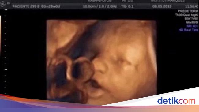 Seperti Bernyanyi Begini Cara Janin Merespons Suara Dari Luar