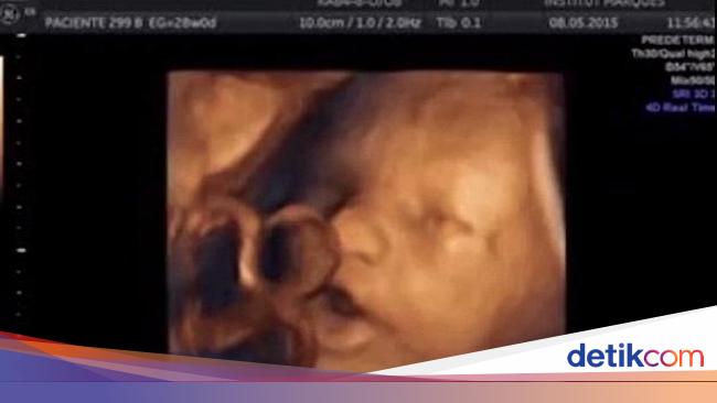 Seperti Bernyanyi Begini Cara Janin Merespons Suara Dari Luar