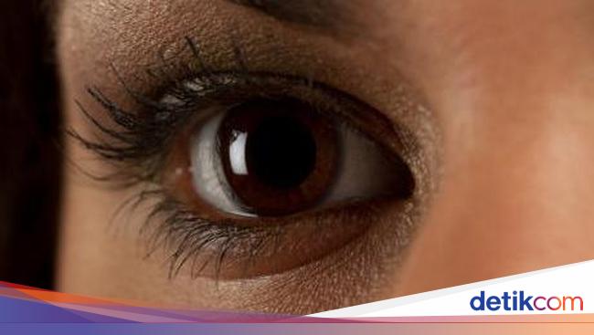 Jangan Dikucek Ini Saran Dokter Bila Mata Perih Kena Hand Sanitizer