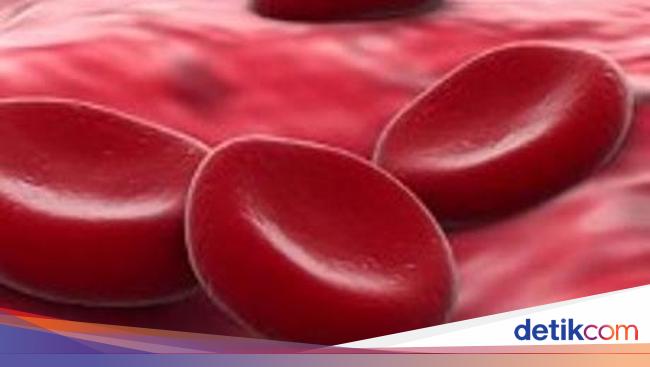 Thalassemia Tak Dapat Disembuhkan Penyakit Apa Itu