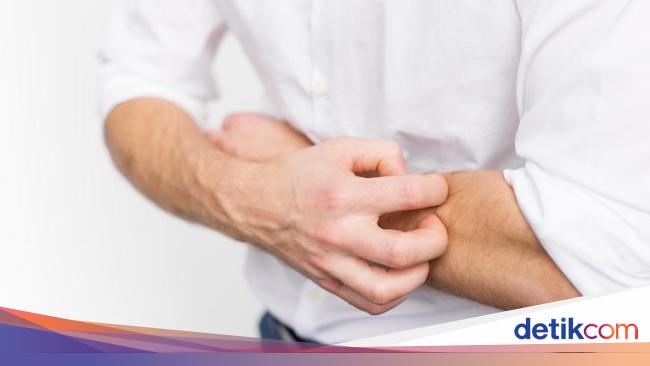 Badan Gatal Tanpa Sebab Mungkin Ini Penyebabnya
