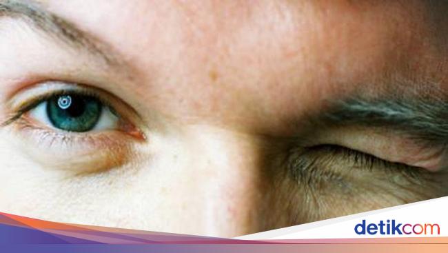 Sakit Mata Menular Lewat Pandangan Bisakah Sakit Mata Menular Lewat Pandangan Bisakah