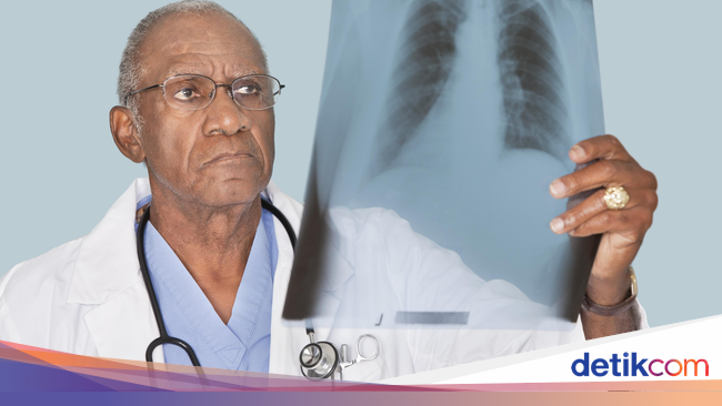 Pada Orang Dewasa Pneumonia Bisa Sebabkan Gampang Pada Orang Dewasa Pneumonia Bisa Sebabkan Gampang