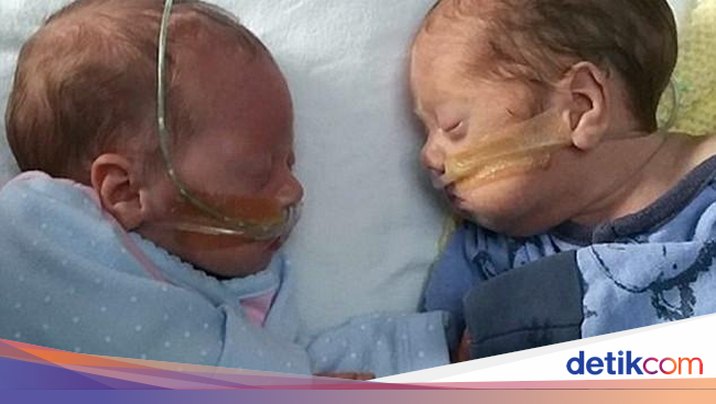 Dua Bayi Mungil yang Prematur ini Dihangatkan dalam 
