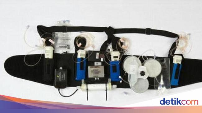 Dengan Alat Ini Cuci Darah Bisa Dilakukan Sambil Makan Dan Mandi