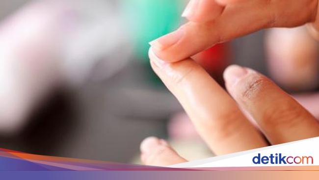 9 Kondisi Kuku Yang Menunjukkan Ada Penyakit Di Tubuh Anda