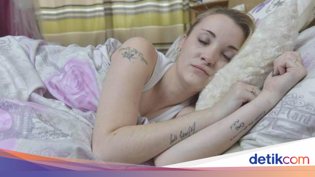 Bak Putri Tidur, Wanita Ini Tak Bangun Selama 2 Minggu 