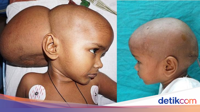 Demi Target ke 16 Besar