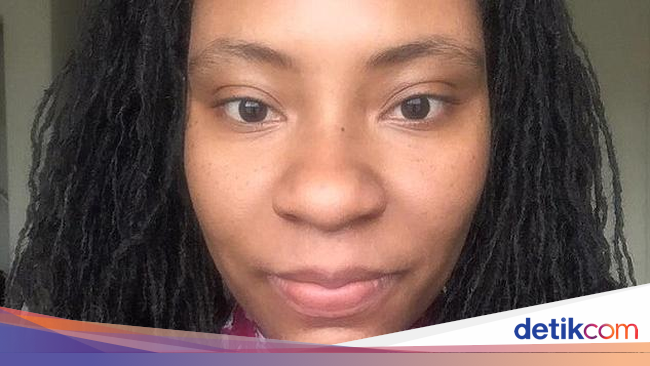 Wajah Bengkak Sampai Mata Tidak Bisa Terbuka Gara gara Cat   Wajah Bengkak Sampai Mata Tidak Bisa Terbuka Gara gara Cat