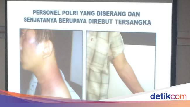Kapolri Tunjukkan Foto Luka-luka Anggota Densus 88 yang 