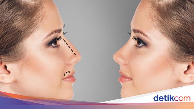 Hidung Palsu Ini Banyak Dipakai Selebgram untuk Terlihat Hidung Palsu Ini Banyak Dipakai Selebgram untuk Terlihat