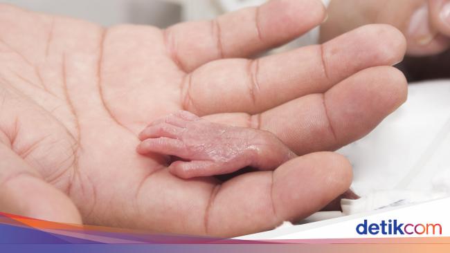 Ayah Dan Ibu Perlu Tahu 3 Kategori Usia Bayi Prematur