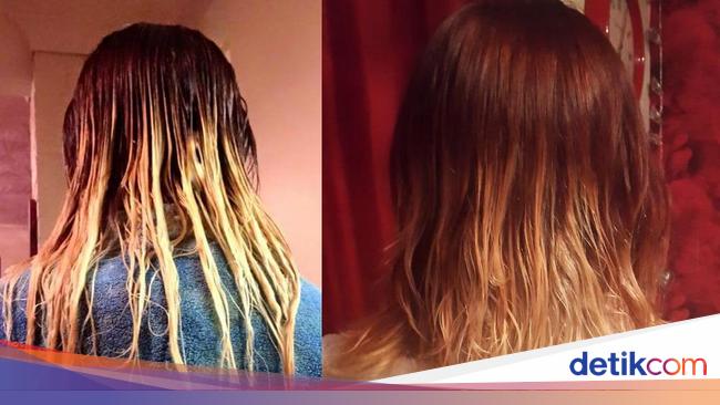  Rambut  Remaja  Ini Rontok dan Terbakar Setelah Cat  Ombre