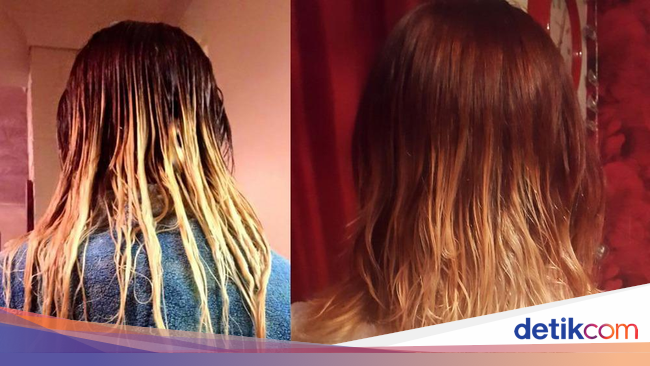  Rambut  Remaja Ini Rontok dan Terbakar Setelah Cat  Ombre