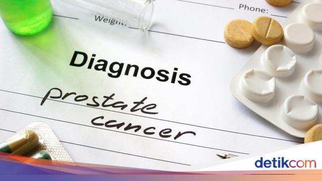 Need to know!  4 Traditional Medicines to Prevent Prostate Cancer