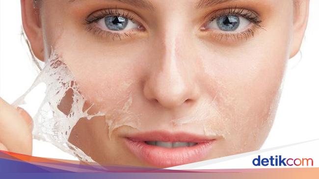 7 Cara Mengatasi Kulit Kering Dan Mengelupas