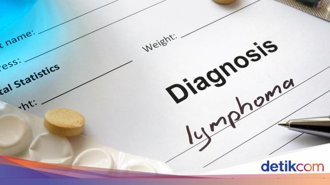 Perbedaan Kanker Limfoma Hodgkin Dan Non Hodgkin