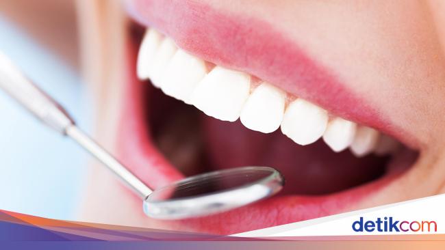 Dokter Gaul Sisa Akar Gigi