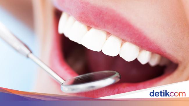 15 Cara Mengobati Gusi Bengkak Agar Cepat Kempes