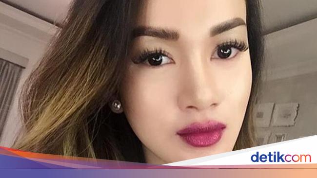 Tips Miliki Wajah Flawless Bebas Jerawat Secantik Astrid Satwika
