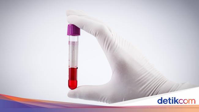 The Rare and Valuable Rh-null Blood Type: Risks and Concerns