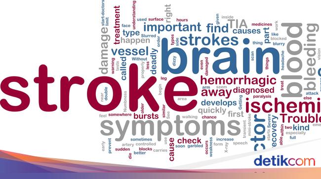 Learning from Tukul Arowana, this is a mandatory check-up to avoid stroke