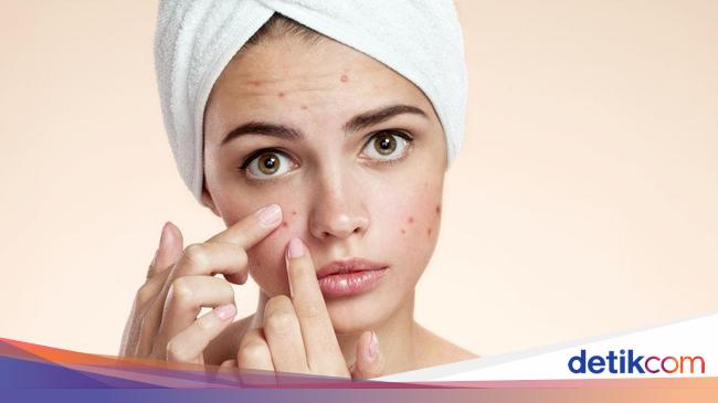 4 Cara Menghilangkan Bruntusan Di Wajah Yang Bisa Kamu Coba Di Rumah