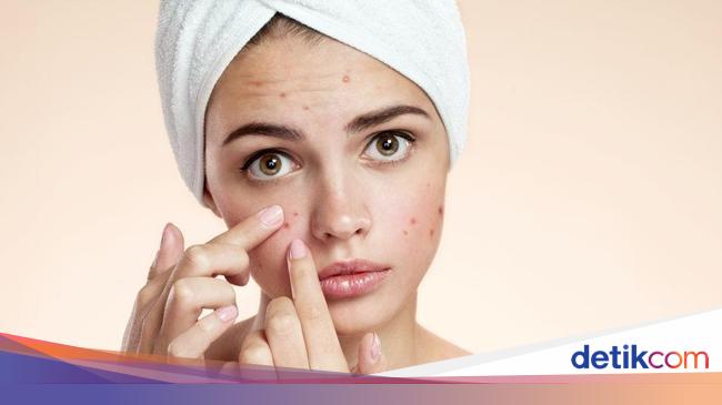 4 Cara Menghilangkan Bruntusan Di Wajah Yang Bisa Kamu Coba Di Rumah
