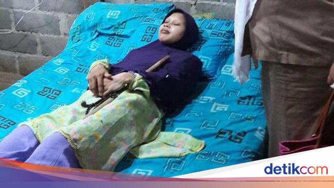 Perjuangan Sulami 'Manusia Kayu' Lawan Penyakit Hingga Wafat