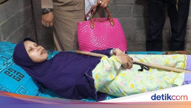 Akhir Perjuangan Sulami 'Si Manusia Kayu' Asal Sragen